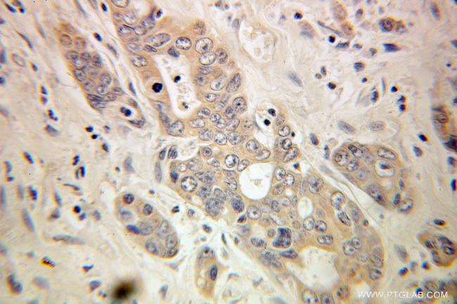 Torsin A Antibody in Immunohistochemistry (Paraffin) (IHC (P))