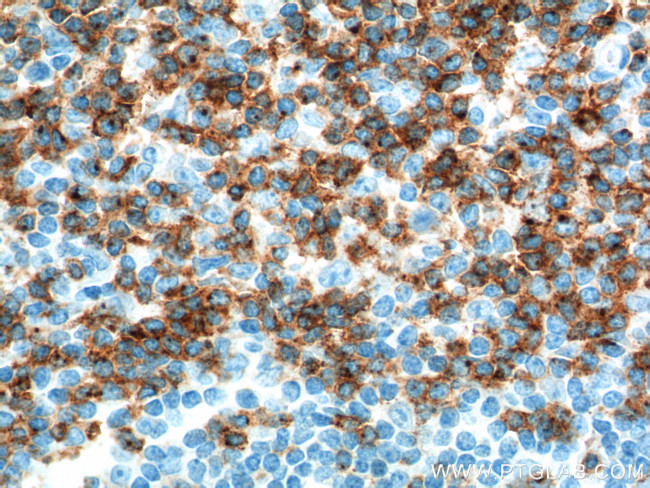 CD2 Antibody in Immunohistochemistry (Paraffin) (IHC (P))
