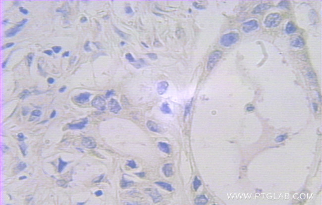 FAM127A Antibody in Immunohistochemistry (Paraffin) (IHC (P))