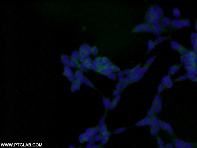 AMPK beta 1 Antibody in Immunocytochemistry (ICC/IF)