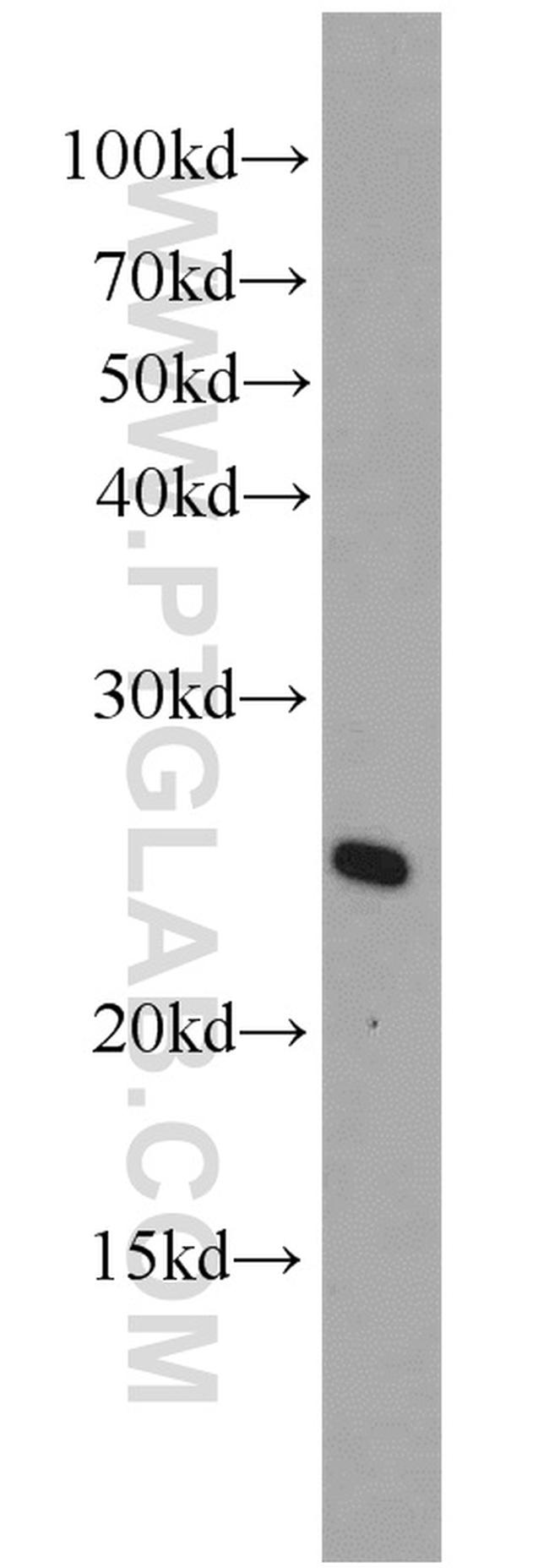 ARL4 Antibody in Western Blot (WB)