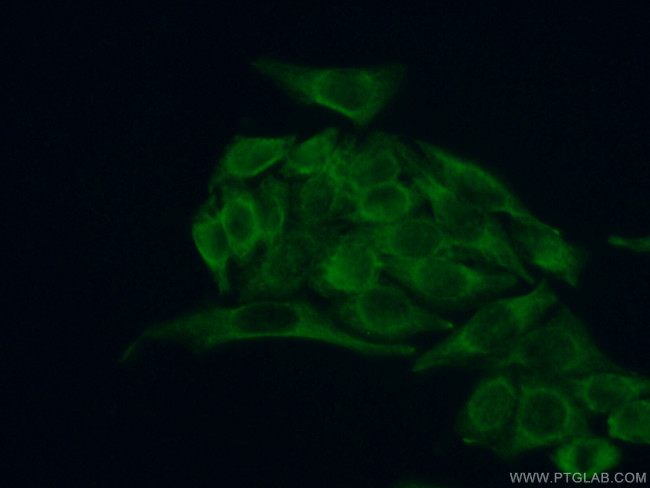 Stanniocalcin 2 Antibody in Immunocytochemistry (ICC/IF)