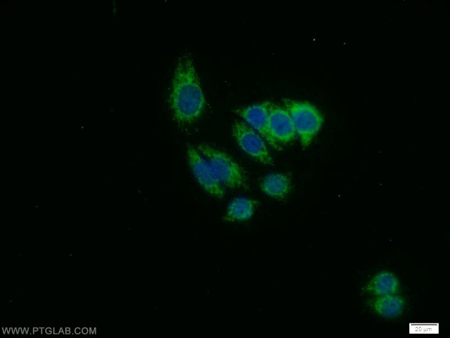 WBP11 Antibody in Immunocytochemistry (ICC/IF)