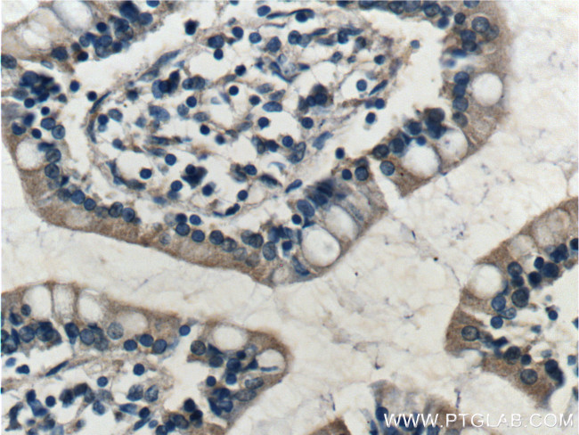 RAMP1 Antibody in Immunohistochemistry (Paraffin) (IHC (P))