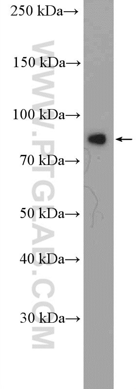 Zyxin Antibody in Western Blot (WB)