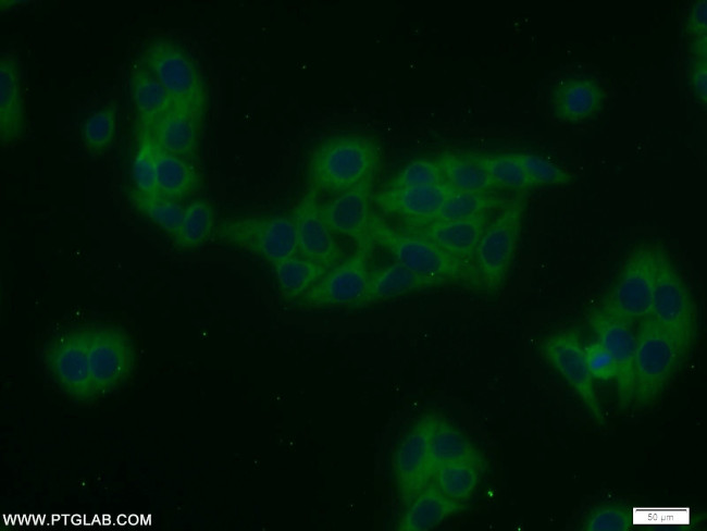TRAIP Antibody in Immunocytochemistry (ICC/IF)