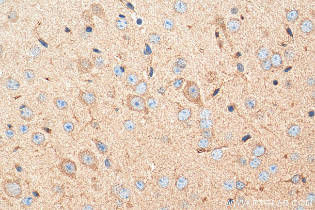 CHRNA3 Antibody in Immunohistochemistry (Paraffin) (IHC (P))