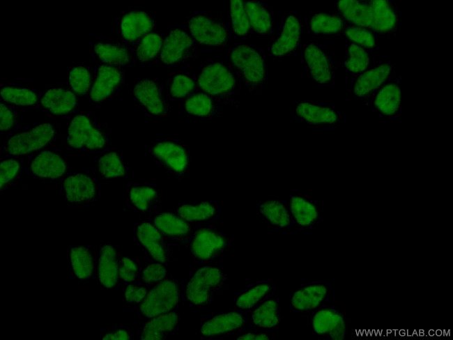 MAD2L1 Antibody in Immunocytochemistry (ICC/IF)