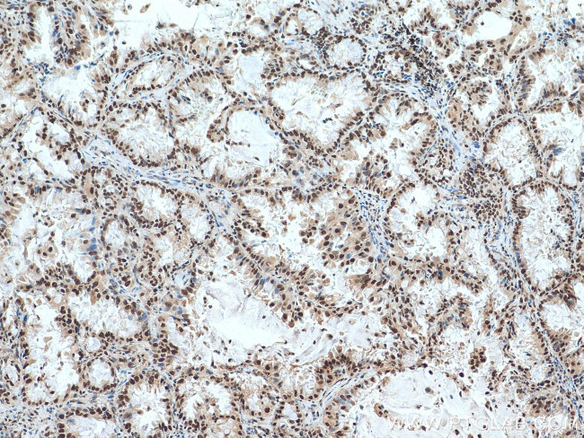 ACTL6A Antibody in Immunohistochemistry (Paraffin) (IHC (P))