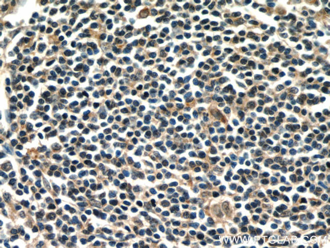 CD320 Antibody in Immunohistochemistry (Paraffin) (IHC (P))