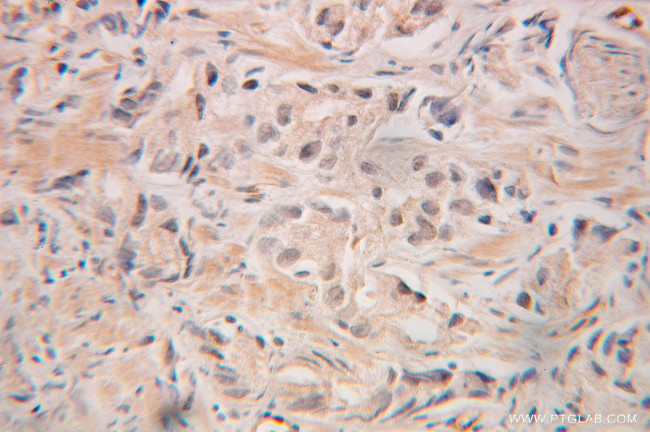 GRWD1 Antibody in Immunohistochemistry (Paraffin) (IHC (P))