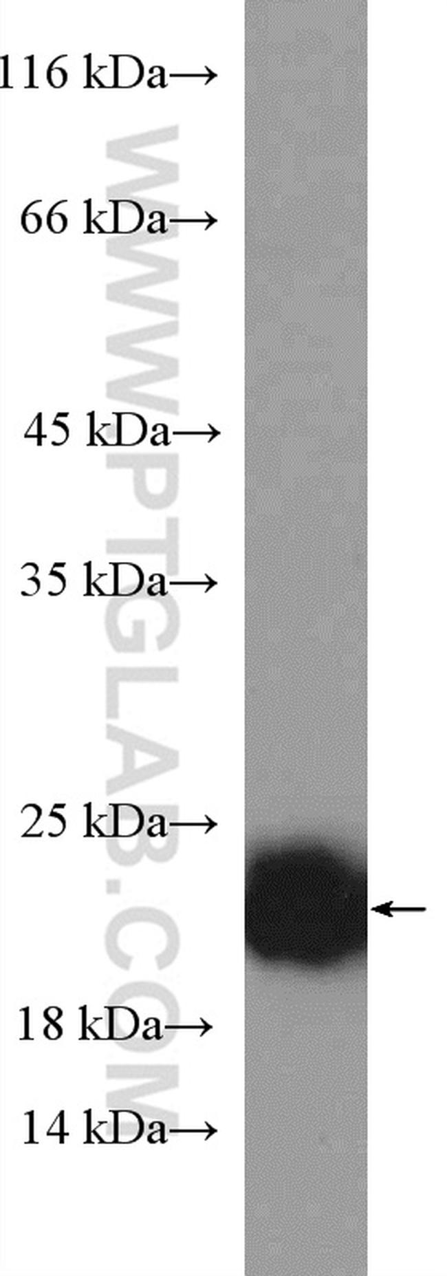 P21 Test P21 Polyclonal Antibody | Invitrogen (10355-1-AP)