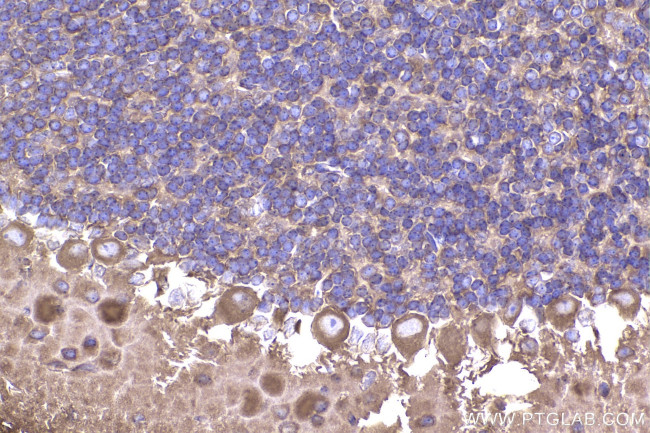 ACTR1A Antibody in Immunohistochemistry (Paraffin) (IHC (P))