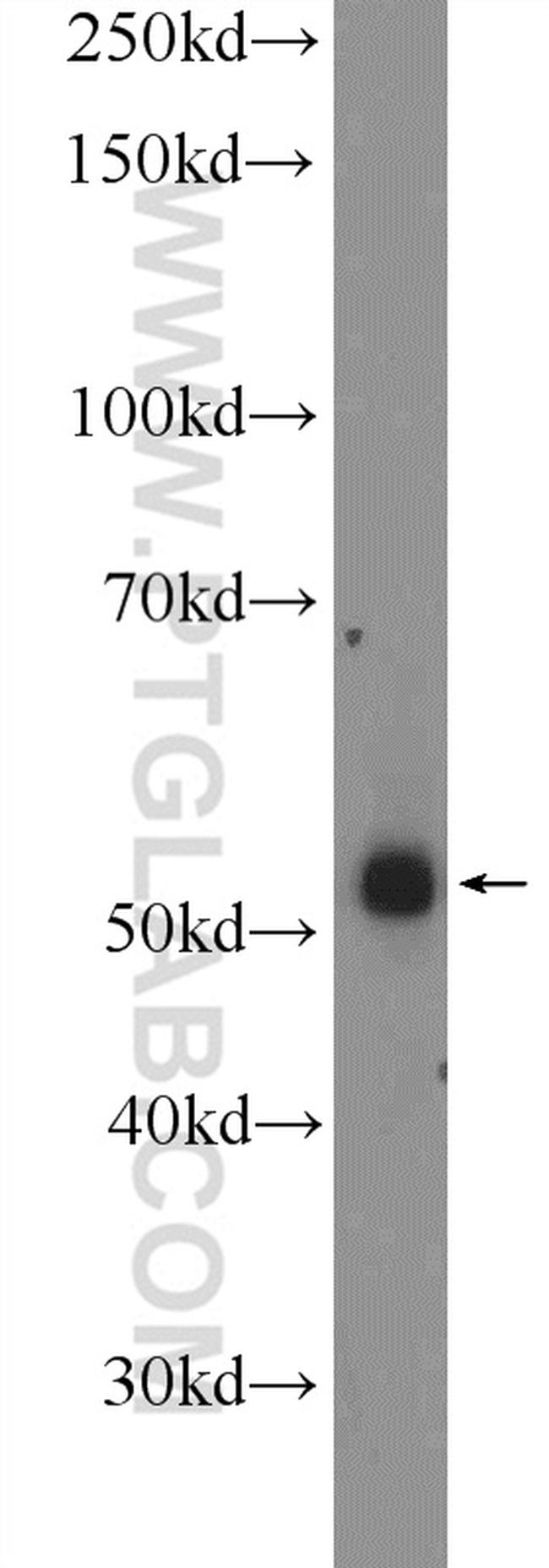ZNF256 Antibody in Western Blot (WB)