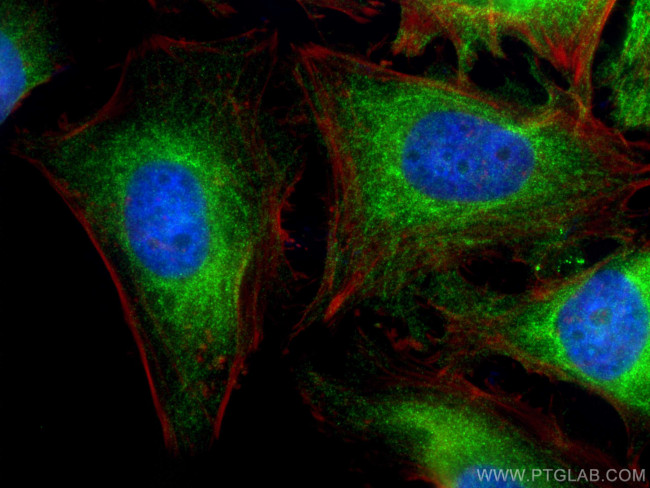 BNIP2 Antibody in Immunocytochemistry (ICC/IF)