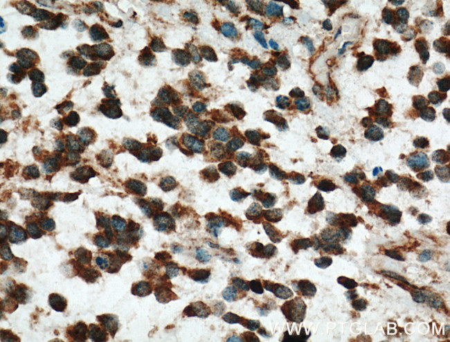 RAP1GDS1 Antibody in Immunohistochemistry (Paraffin) (IHC (P))