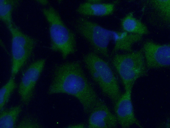 NEK6 Antibody in Immunocytochemistry (ICC/IF)