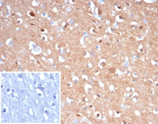 Tubulin beta 3/TUBB3 (Neuronal and Stem Cell Marker) Antibody in Immunohistochemistry (Paraffin) (IHC (P))