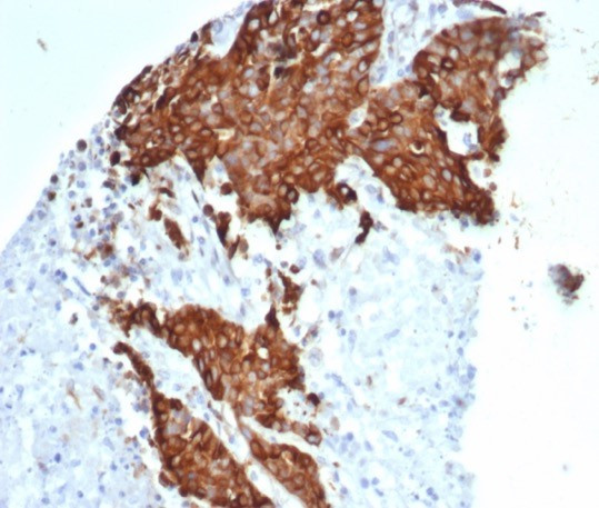 Tubulin beta 3/TUBB3 (Neuronal and Stem Cell Marker) Antibody in Immunohistochemistry (Paraffin) (IHC (P))