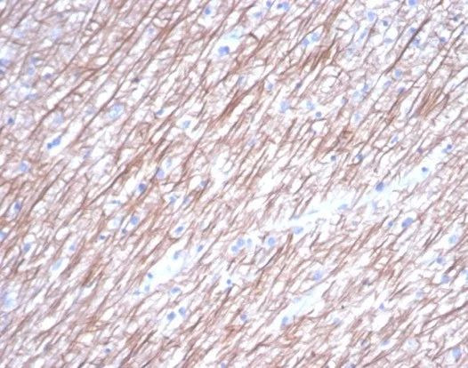 Tubulin beta 3/TUBB3 (Neuronal and Stem Cell Marker) Antibody in Immunohistochemistry (Paraffin) (IHC (P))