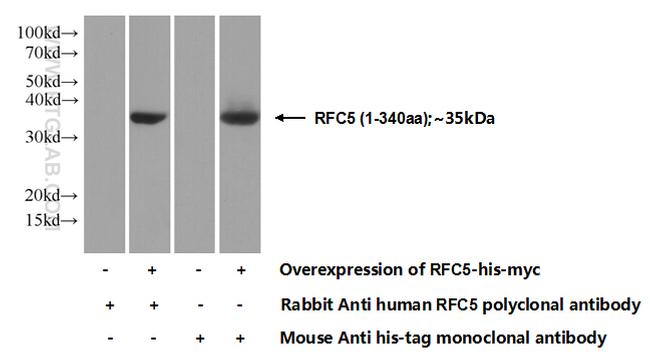RFC5 Antibody in Western Blot (WB)