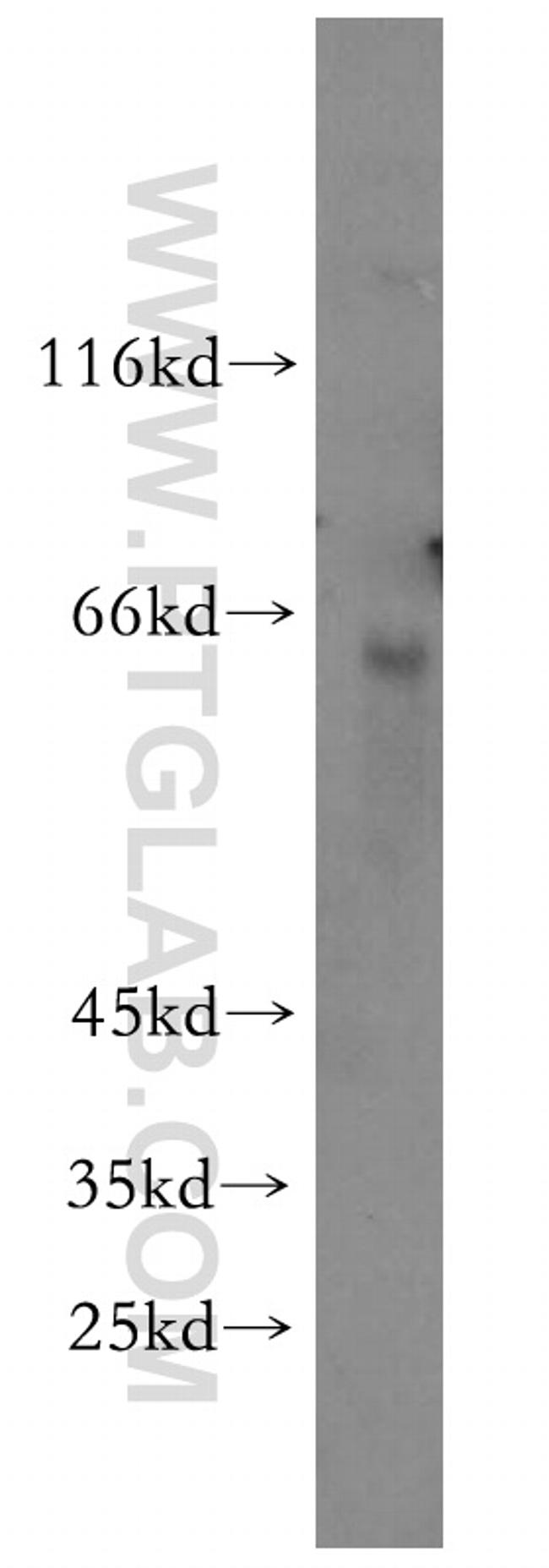 KRBP Antibody in Western Blot (WB)