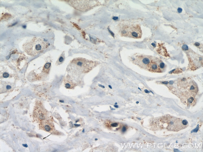 USP2 Antibody in Immunohistochemistry (Paraffin) (IHC (P))