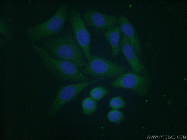 COMMD5 Antibody in Immunocytochemistry (ICC/IF)