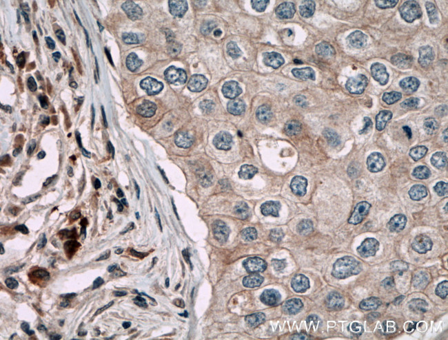 CARD14 Antibody in Immunohistochemistry (Paraffin) (IHC (P))