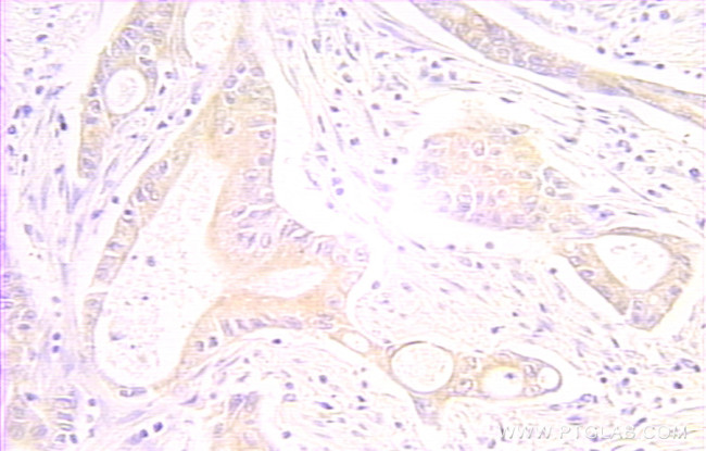 RAIDD Antibody in Immunohistochemistry (Paraffin) (IHC (P))