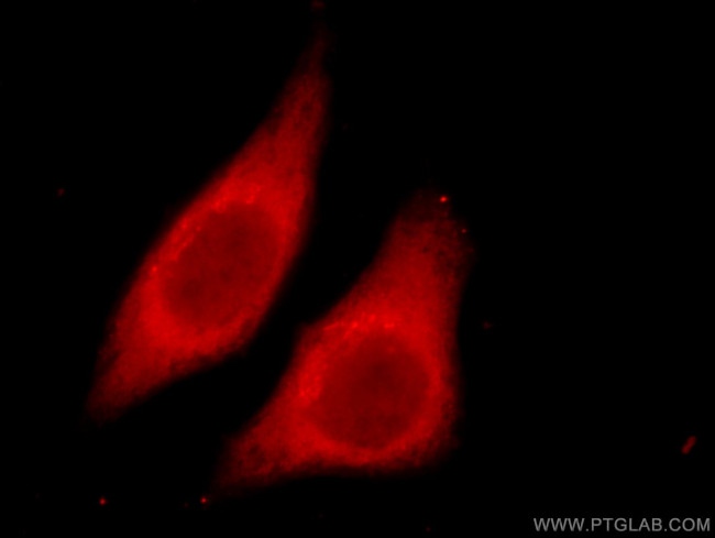 Cytohesin 2 Antibody in Immunocytochemistry (ICC/IF)
