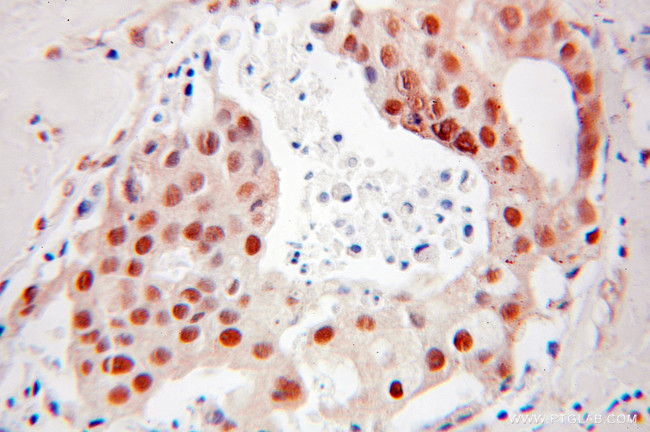 DR1 Antibody in Immunohistochemistry (Paraffin) (IHC (P))