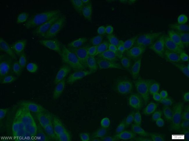 NFKB2 p100 Antibody in Immunocytochemistry (ICC/IF)