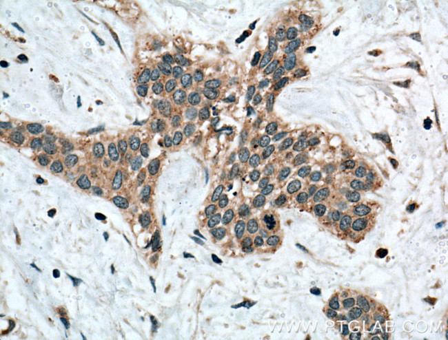 Calpain 3 Antibody in Immunohistochemistry (Paraffin) (IHC (P))