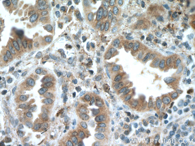 SLC25A3 Antibody in Immunohistochemistry (Paraffin) (IHC (P))