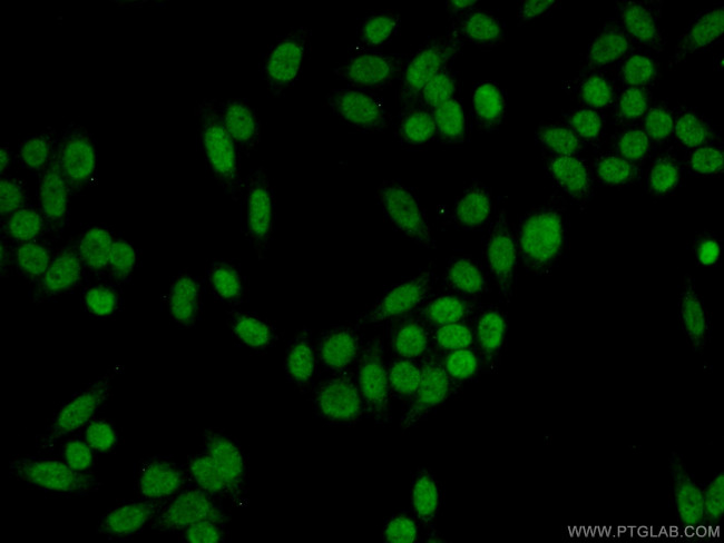 DDB2 Antibody in Immunocytochemistry (ICC/IF)