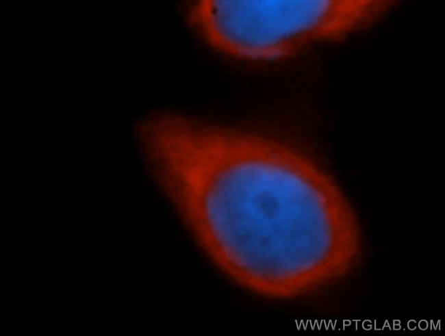 EIF3J Antibody in Immunocytochemistry (ICC/IF)