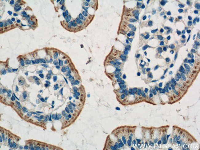 HTR3A Antibody in Immunohistochemistry (Paraffin) (IHC (P))