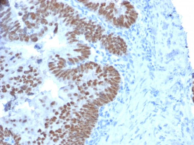 CDX2/Caudal Type Homeobox 2 (GI Epithelial Marker) Antibody in Immunohistochemistry (Paraffin) (IHC (P))