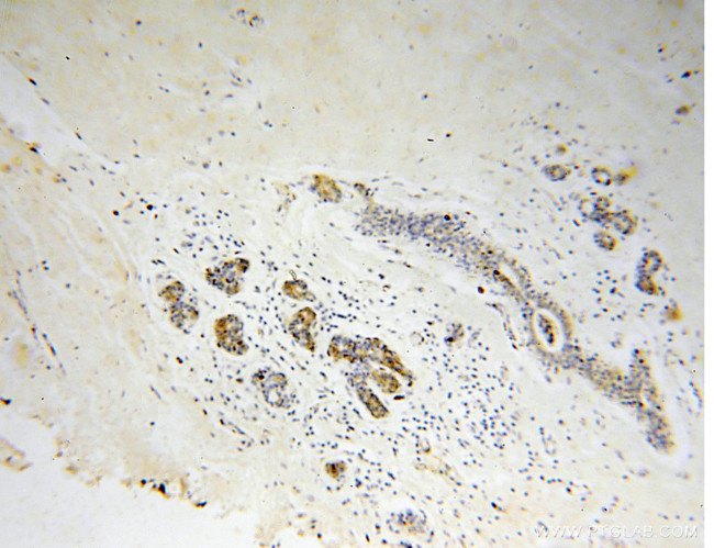 Connexin-32 Antibody in Immunohistochemistry (Paraffin) (IHC (P))