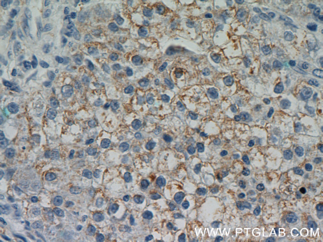 DSE Antibody in Immunohistochemistry (Paraffin) (IHC (P))
