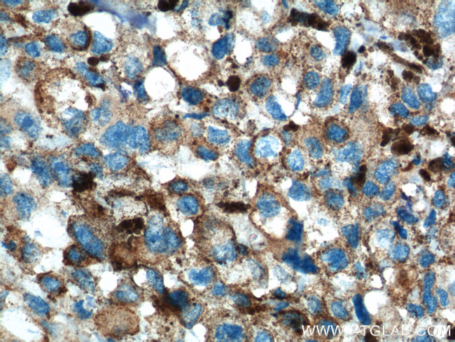 SLC45A2 Antibody in Immunohistochemistry (Paraffin) (IHC (P))