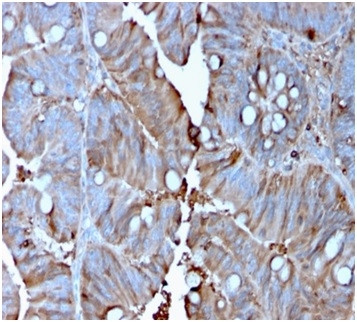 MerTK (Innate Immune Checkpoint) Antibody in Immunohistochemistry (Paraffin) (IHC (P))