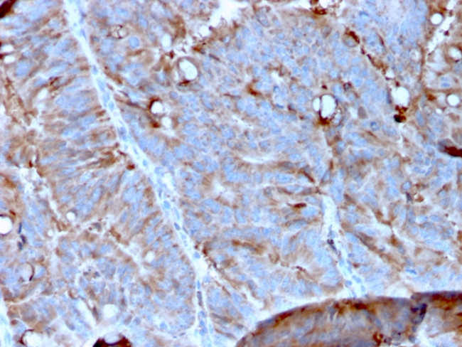 MerTK (Innate Immune Checkpoint) Antibody in Immunohistochemistry (Paraffin) (IHC (P))