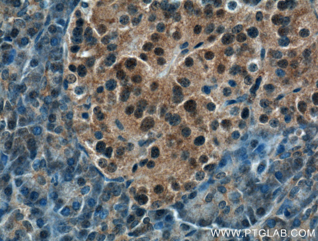 COPS4 Antibody in Immunohistochemistry (Paraffin) (IHC (P))