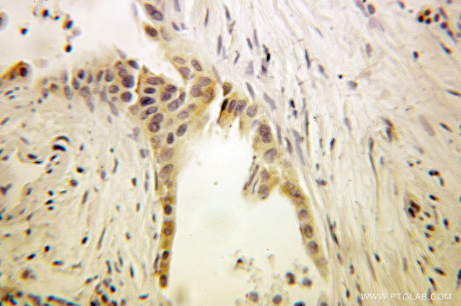 EEF1B2 Antibody in Immunohistochemistry (Paraffin) (IHC (P))