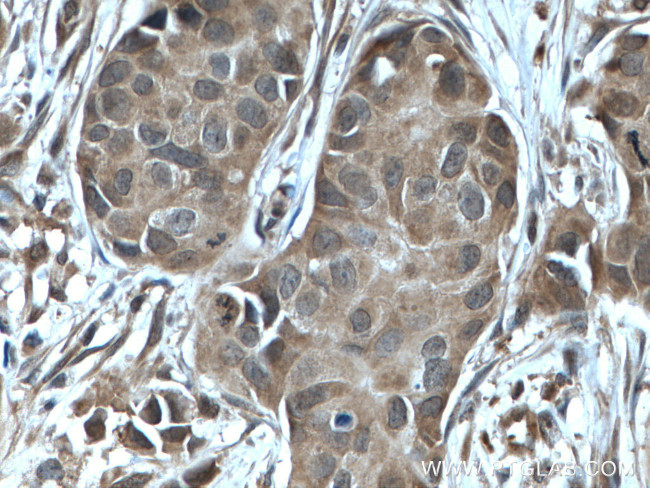 NUDT2 Antibody in Immunohistochemistry (Paraffin) (IHC (P))
