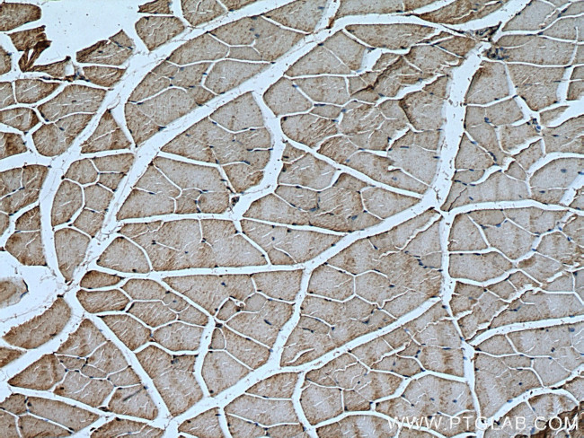 Calpain 3 Antibody in Immunohistochemistry (Paraffin) (IHC (P))