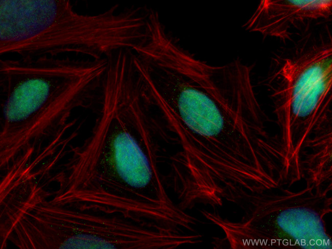 HOXD3 Antibody in Immunocytochemistry (ICC/IF)