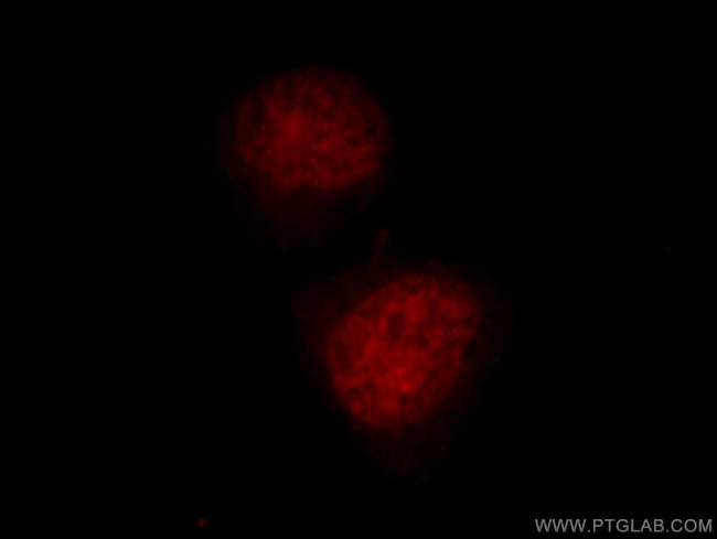 TCEB3 Antibody in Immunocytochemistry (ICC/IF)
